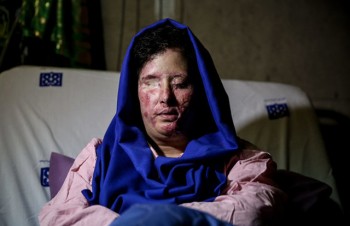 عاملان پرونده اسیدپاشی اصفهان هنوز شناسایی نشده اند