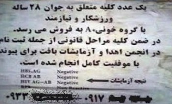 فروش كليه كارمند پتروشيمى خارگ براى امرار معاش!