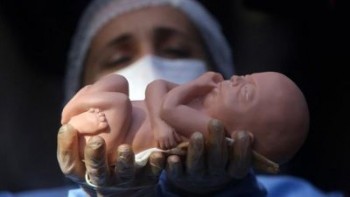 آمار سقط جنین در ایران ۲۰ برابر تلفات سوانح رانندگی است