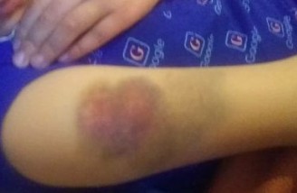 تنبیه بدنی یک دانش آموز پایه سوم ابتدایی در استان قزوین 