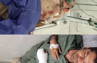 ۲محیط‌بان بوشهری هدف گلوله شکارچیان قرار گرفتند