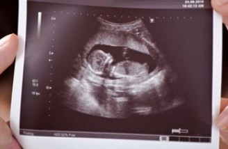 سالانه ۱۲ هزار پرونده سقط جنین درمانی در ایران وجود دارد