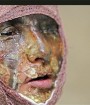 خودداری از قصاص اسیدپاش‌ها؛ اعمال سلیقه شخصی یا ضعف قانونی؟