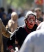 انفجار مهیب کابل 100 کشته و 400 مجروح برجای گذاشت