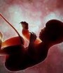 ۹۵ درصد از سقط‌ جنین های ایران غیرقانونی است
